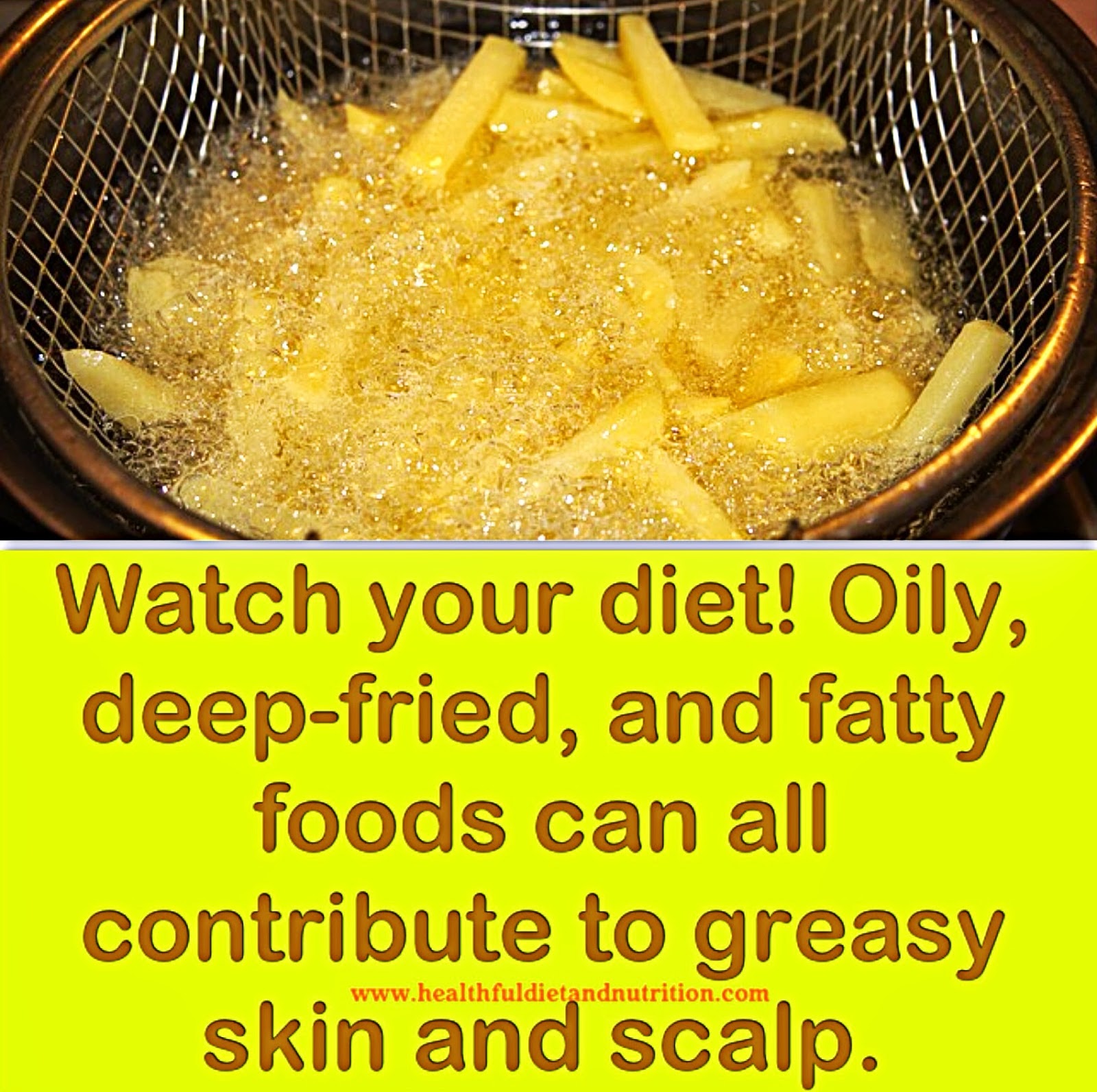 Watch Your Diet To Prevent Greasy SKin And Scalp