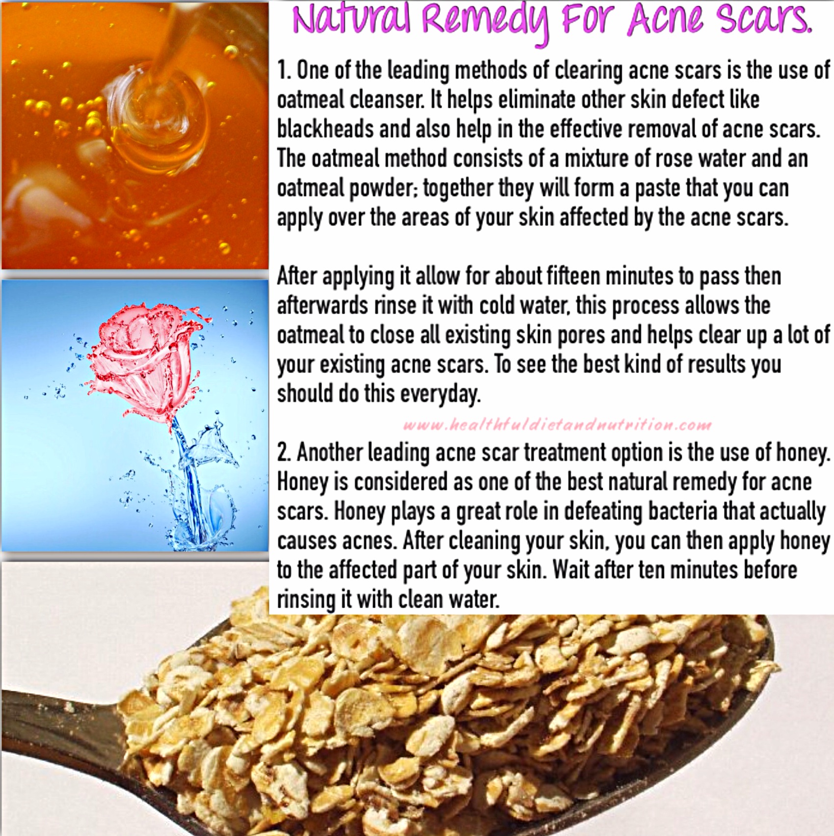 Natural Remedies For Acne Scars