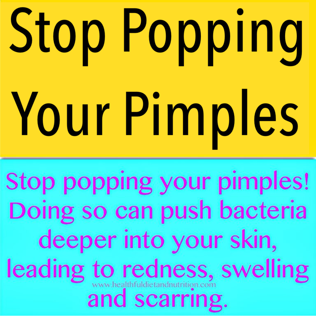 Stop Popping Your Pimples