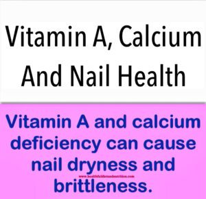 Vitamin A and calcium play crucial roles in maintaining nail health. Vitamin A supports the production of sebum, which keeps nails hydrated and prevents brittleness. Additionally, it promotes cell growth, fostering the development of strong, resilient nails. Calcium is essential for nail structure; it provides strength and helps prevent breakage. A deficiency in calcium may lead to weak and brittle nails. Incorporating foods rich in these nutrients, such as leafy greens, dairy products, and carrots, can enhance nail health. Adequate hydration and overall nutrition are also vital for maintaining robust and healthy nails.