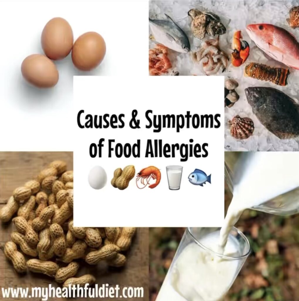 Causes & Symptoms of Food Allergies