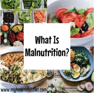 What Is Malnutrition? www.myhealthfuldiet.com