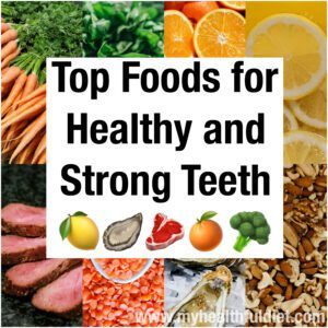 Top Foods for Healthy and Strong Teeth