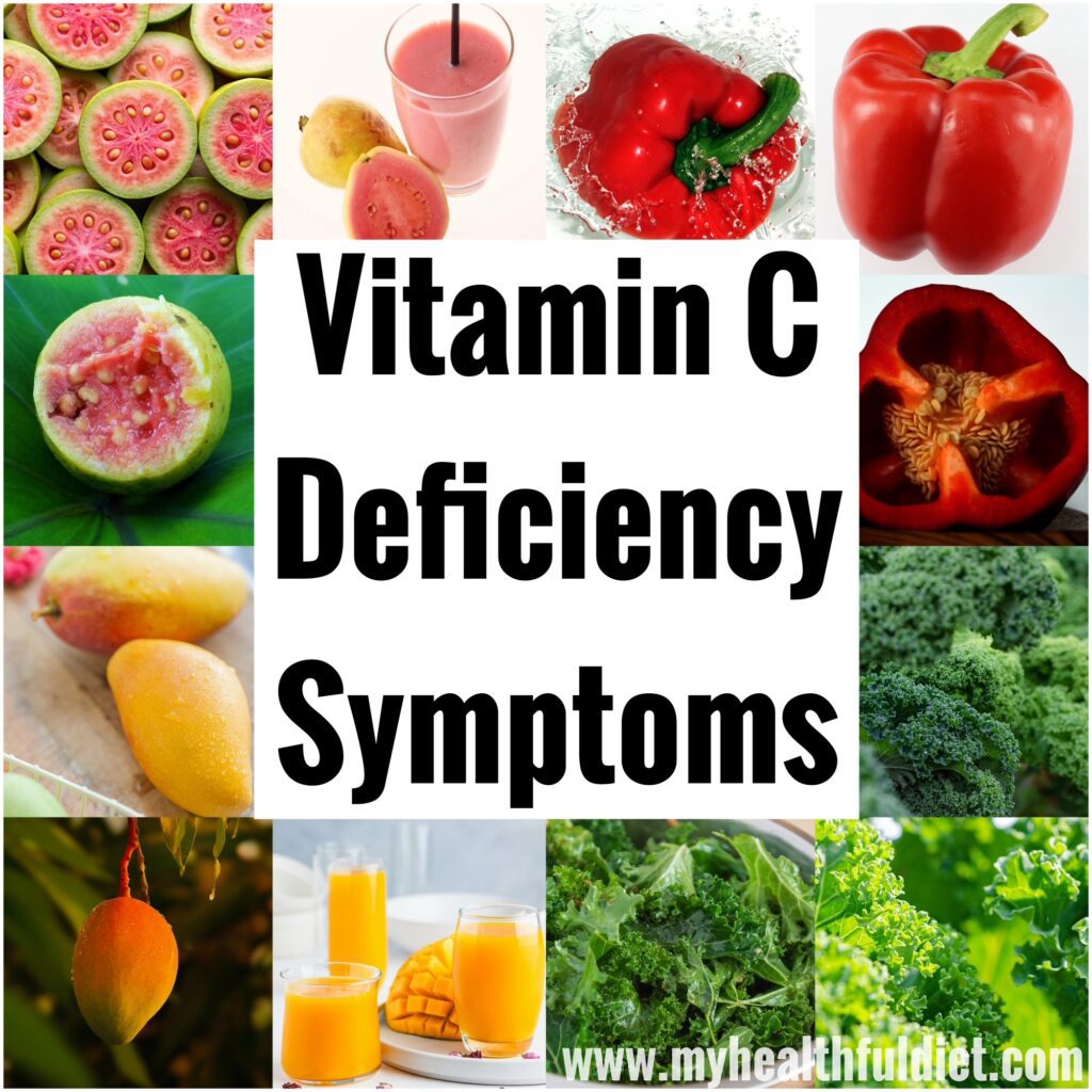 Vitamin C Deficiency Symptoms