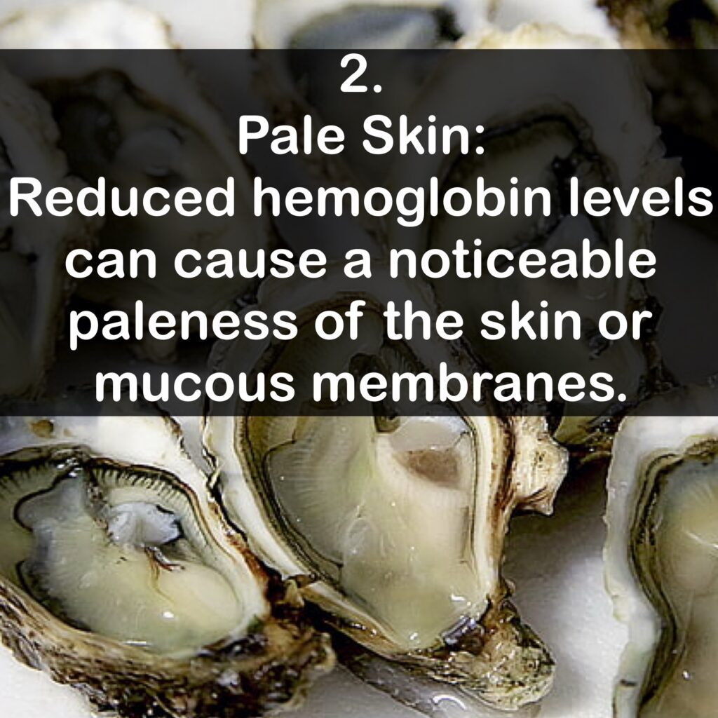 2. Pale Skin: Reduced hemoglobin levels can cause a noticeable paleness of the skin or mucous membranes.