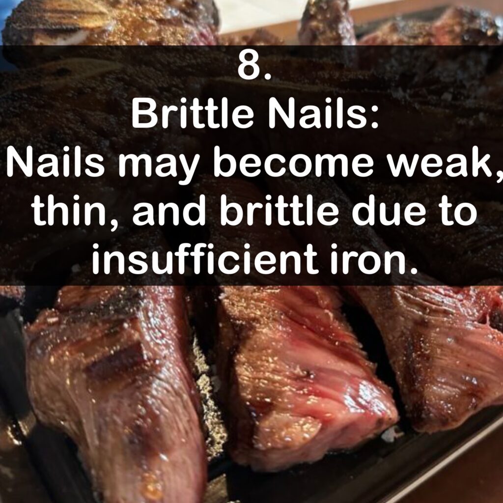 8. Brittle Nails: Nails may become weak, thin, and brittle due to insufficient iron.