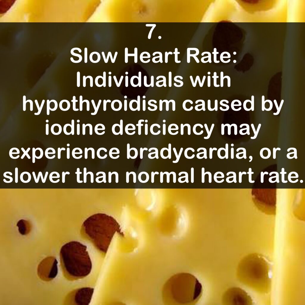 7. Slow Heart Rate: Individuals with hypothyroidism caused by iodine deficiency may experience bradycardia, or a slower than normal heart rate.