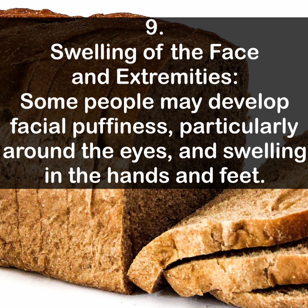 9. Swelling of the Face and Extremities: Some people may develop facial puffiness, particularly around the eyes, and swelling in the hands and feet.