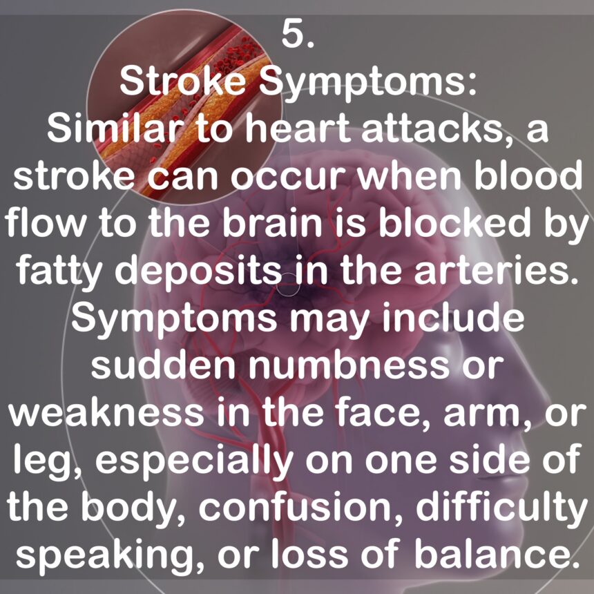 5. Stroke Symptoms: Similar to heart attacks, a stroke can occur when blood flow to the brain is blocked by fatty deposits in the arteries. Symptoms may include sudden numbness or weakness in the face, arm, or leg, especially on one side of the body, confusion, difficulty speaking, or loss of balance.