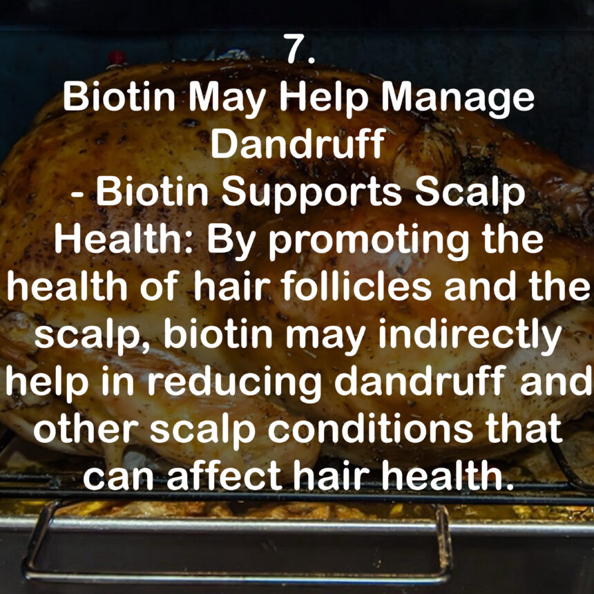 7. Biotin May Help Manage Dandruff - Biotin Supports Scalp Health: By promoting the health of hair follicles and the scalp, biotin may indirectly help in reducing dandruff and other scalp conditions that can affect hair health.