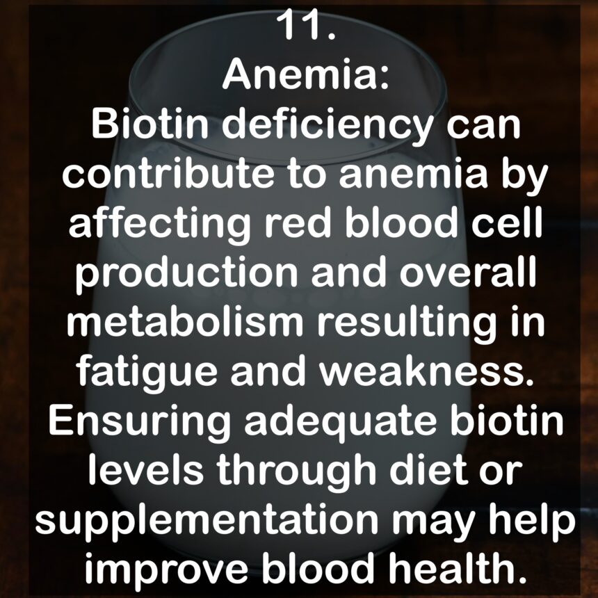 11. Anemia: Biotin deficiency can contribute to anemia by affecting red blood cell production and overall metabolism resulting in fatigue and weakness. Ensuring adequate biotin levels through diet or supplementation may help improve blood health.