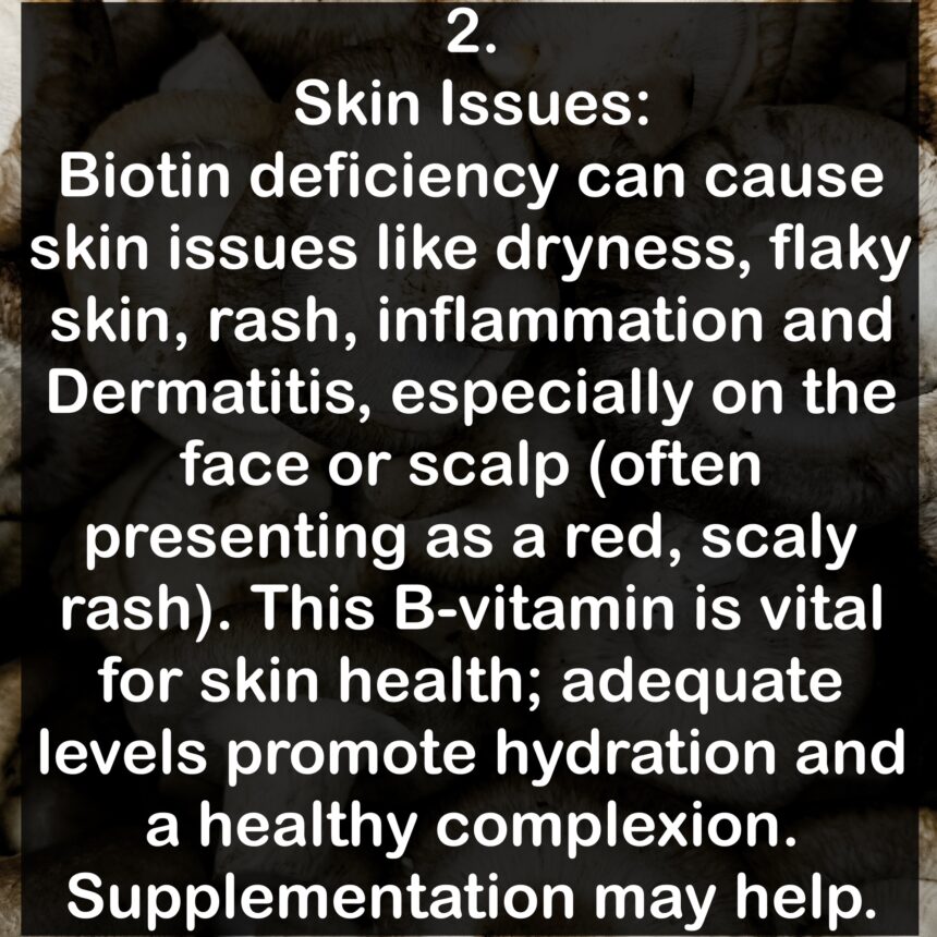 2. Skin Issues: Biotin deficiency can cause skin issues like dryness, flaky skin, rash, inflammation and Dermatitis, especially on the face or scalp (often presenting as a red, scaly rash). This B-vitamin is vital for skin health; adequate levels promote hydration and a healthy complexion. Supplementation may help.