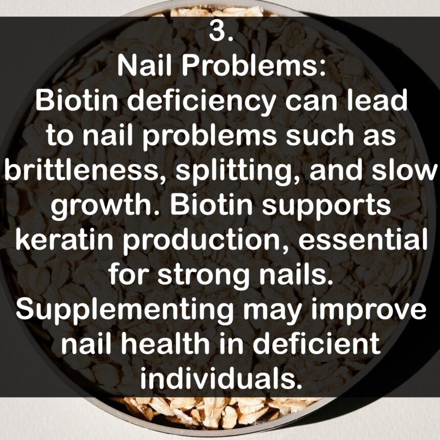 3. Nail Problems: Biotin deficiency can lead to nail problems such as brittleness, splitting, and slow growth. Biotin supports keratin production, essential for strong nails. Supplementing may improve nail health in deficient individuals.