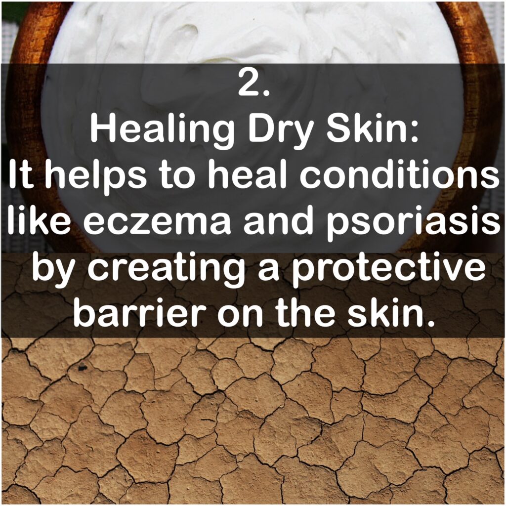 2. Healing Dry Skin: It helps to heal conditions like eczema and psoriasis by creating a protective barrier on the skin.
