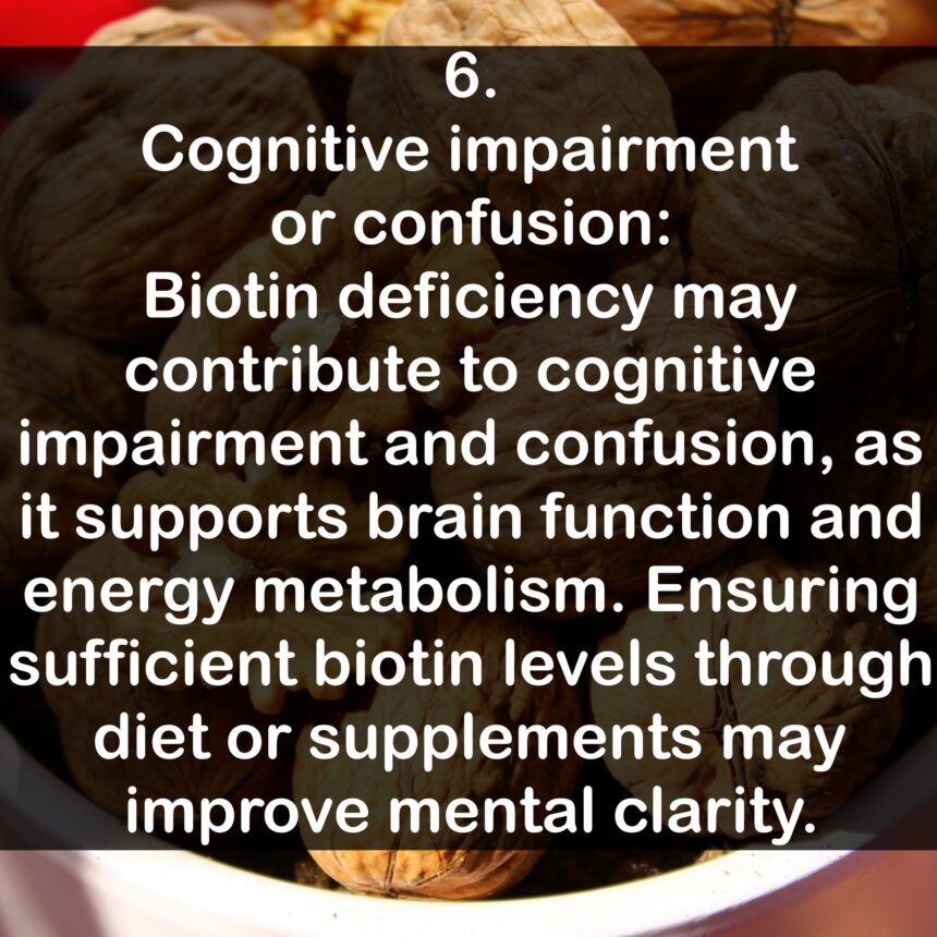 6. Cognitive impairment or confusion: Biotin deficiency may contribute to cognitive impairment and confusion, as it supports brain function and energy metabolism. Ensuring sufficient biotin levels through diet or supplements may improve mental clarity.