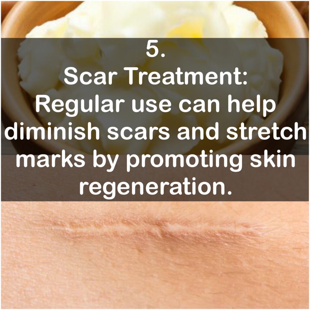 5. Scar Treatment: Regular use can help diminish scars and stretch marks by promoting skin regeneration.