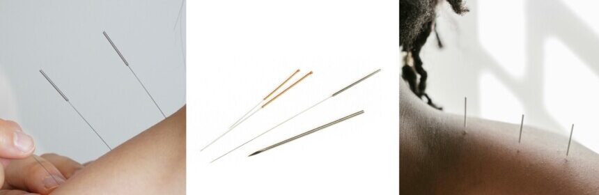 How Does Acupuncture Work?