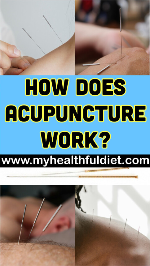 How Does Acupuncture Work?