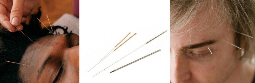 How Acupuncture Can Relieve Your Headache Pains