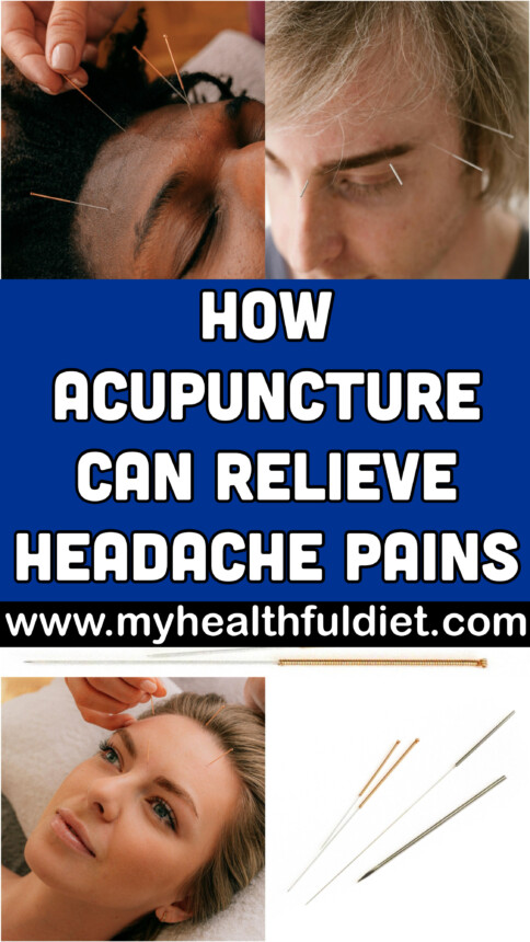 How Acupuncture Can Relieve Your Headache Pains