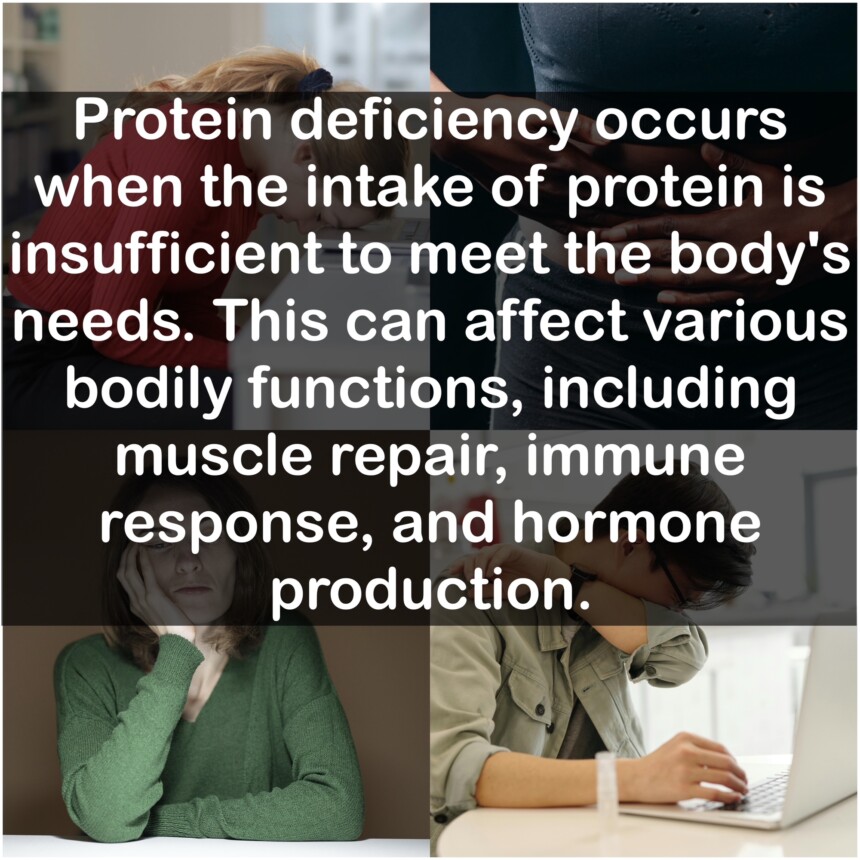 Protein deficiency occurs when the intake of protein is insufficient to meet the body's needs. This can affect various bodily functions, including muscle repair, immune response, and hormone production.