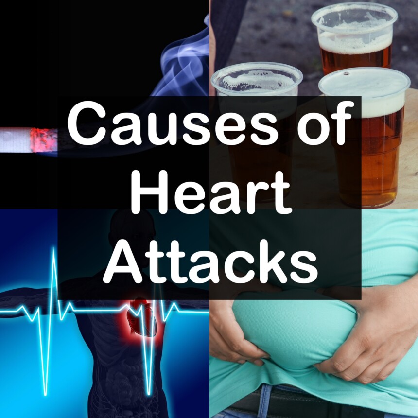 Causes of Heart Attacks