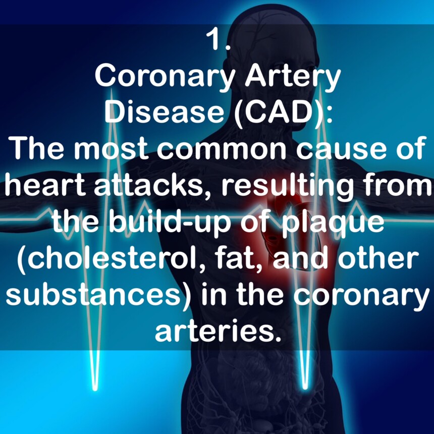 1. Coronary Artery Disease (CAD): The most common cause of heart attacks, resulting from the build-up of plaque (cholesterol, fat, and other substances) in the coronary arteries.