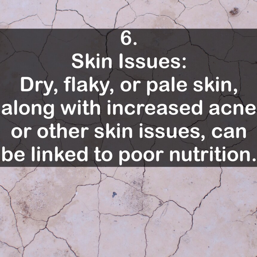 6. Skin Issues: Dry, flaky, or pale skin, along with increased acne or other skin issues, can be linked to poor nutrition.